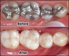 dentalpic